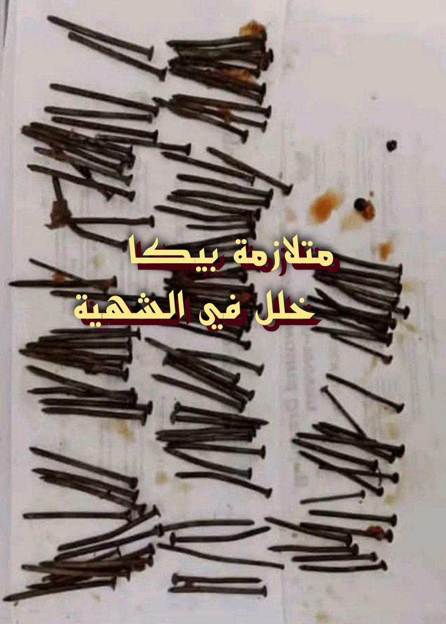 متلازمة بيكا خلل في الشهية